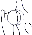 OFA mild hip rating
